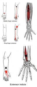 Extensor digitorum a indicis spoušťový bod