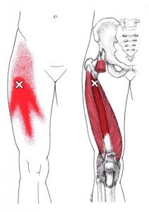 Vastus intermedius spoušťový bod