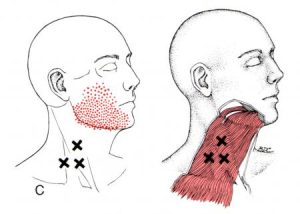 Platysma