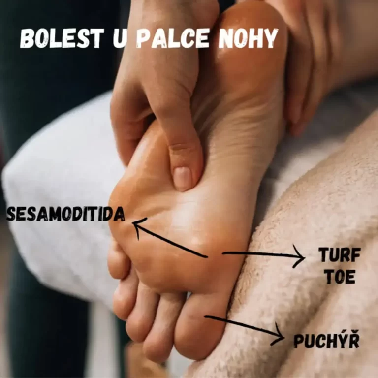 Bolest palce u nohy Bolest palce u nohy při tenisu